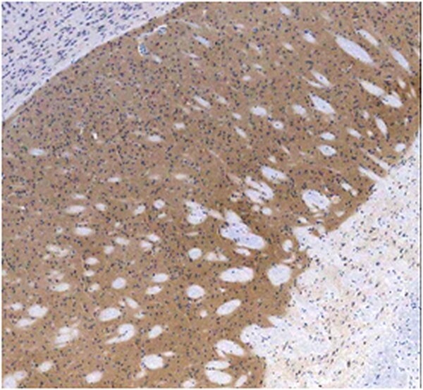 Anti Dopamine D2 Receptor Antibody Abn462